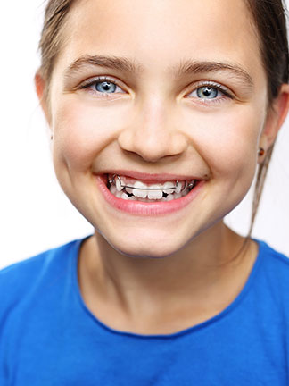 orthodontic treatments